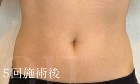 アフターの写真