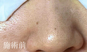 ビフォーの写真