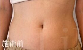 ビフォーの写真